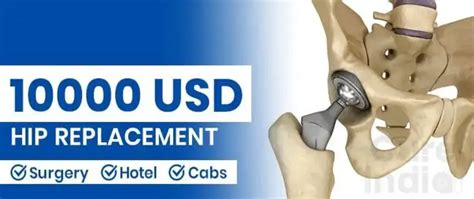 hip surgery greenwich|Treatment Prices .